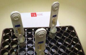 Hiv, ultimi giorni per prenotare test gratuiti della Lila di Cagliari