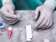 Test antigienici, Cossa (Riform): “Laboratori e farmacie applichino stessi prezzi”