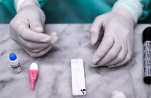 Test antigienici, Cossa (Riform): “Laboratori e farmacie applichino stessi prezzi”