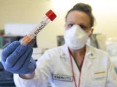 Covid in Italia: 16.974 nuovi positivi, 380 le vittime