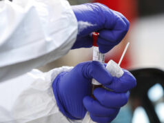 Covid, contagi in aumento regolare: oggi 471 positivi registrati in Sardegna