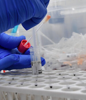 Covid: in Italia 17.221 nuovi contagi e 487 vittime