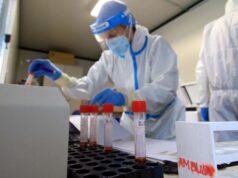 Covid in Sardegna, 328 nuovi casi: terapie intensive e ricoveri in aumento