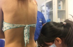 Salute: a Cagliari la campagna di sensibilizzazione sui tumori della pelle