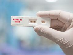 Covid, altri 463 casi e nessun decesso in Sardegna