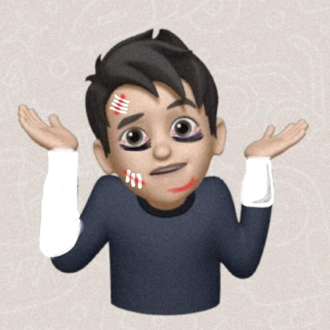 Dopo l’incidente Massimo Zedda torna a casa | Ecco cosa scrive