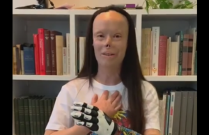 Valentina Pitzalis mostra la nuova mano bionica: “Ora sono una vera Wonder Woman”