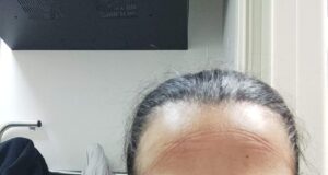 “Siamo stanchi”: sfogo social dell’infermiera del Santissima Trinità