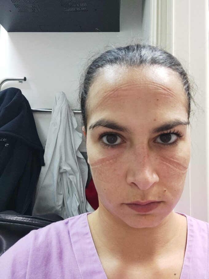 “Siamo stanchi”: sfogo social dell’infermiera del Santissima Trinità