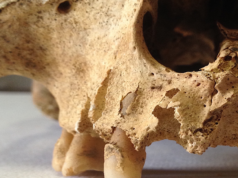 I denti dei centenari consentiranno di capire il segreto della loro longevità