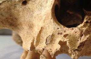 I denti dei centenari consentiranno di capire il segreto della loro longevità