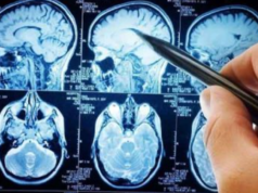 SLA, i pazienti incontrano i vertici di Regione, Università e Aou di Cagliari