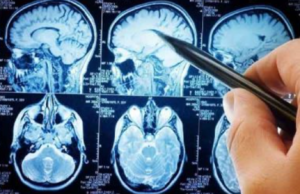 SLA, i pazienti incontrano i vertici di Regione, Università e Aou di Cagliari