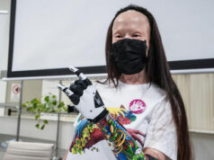 Valentina Pitzalis: con la mano bionica mi sento una wonder woman