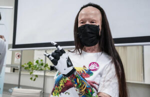 Valentina Pitzalis: con la mano bionica mi sento una wonder woman