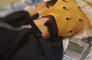 Policlinico Duilio Casula centro di eccellenza per la medicina del sonno