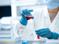 Covid, altri 751 positivi nell’Isola ma non ci sono decessi