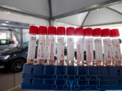 Covid, risalita pericolosa dei contagi e un decesso nella giornata odierna