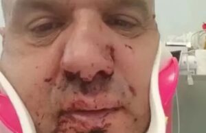 Colpì brutalmente un operatore del 118: dieci mesi di carcere ad un romano