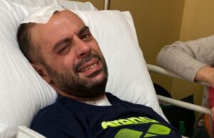 Scappa dall’ospedale dove era ricoverato: Giambroni ritrovato dopo alcune ore