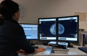 Operativo al Businco un rivoluzionario mammografo per le diagnosi