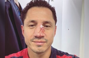 Cagliari-Sassuolo, Lapadula mostra il naso ferito: ecco come sta ora