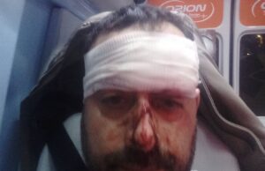 Pestato in pieno centro a Cagliari, la vittima cerca testimoni