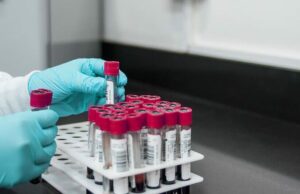 I biologi sardi: “Sconcertati dai 117 milioni non spesi dalla sanità sarda”