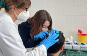 Alopecia Areata Day, al San Giovanni di Dio consulti gratuiti