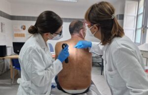 Psoriasi, oltre 5mila i pazienti in cura all’Aou di Cagliari