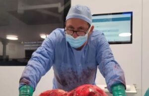 Intervento eccezionale al Mater Olbia: rimosso tumore di 12 chili