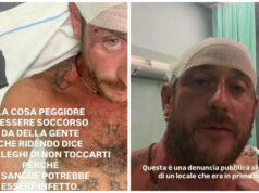 Olbia, aggressione omofoba: sassate e pugni, esplode l’indignazione sui social
